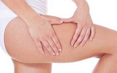 The Way to Get Rid of Cellulite